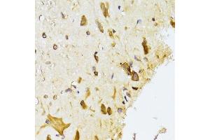 Immunohistochemistry of paraffin-embedded rat spinal cord using RPL13 Antibody.