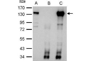 IP Image CIZ1 antibody immunoprecipitates CIZ1 protein in IP experiments. (CIZ1 anticorps)