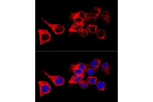 Confocal immunofluorescence analysis of HeLa cells using Cytokeratin 17 (Cytokeratin 17 (KRT17)) antibody (ABIN3023123, ABIN3023124, ABIN3023125 and ABIN6219401) at dilution of 1:200.