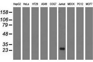 Western blot analysis of extracts (35 µg) from 9 different cell lines by using anti-RIT2 monoclonal antibody. (RIT2 anticorps)
