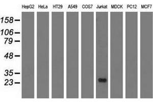 Western blot analysis of extracts (35 µg) from 9 different cell lines by using anti-RIT2 monoclonal antibody.