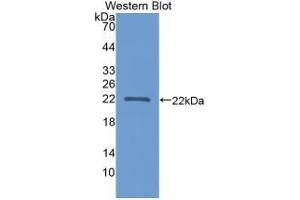 Detection of recombinant APOA1BP using Polyclonal Antibody to Apolipoprotein A1 Binding Protein (APOA1BP)