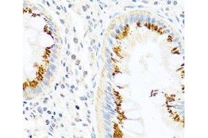 Immunohistochemistry of paraffin-embedded Human colon using FAM3B Polyclonal Antibody at dilution of 1:100 (40x lens). (FAM3B anticorps)