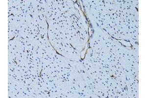 Immunohistochemistry of paraffin-embedded human uterus using SELE Antibody (ABIN5971217) at dilution of 1/100 (40x lens). (Selectin E/CD62e anticorps)