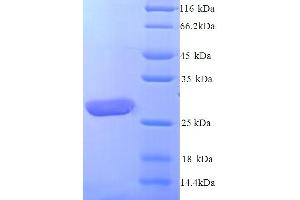 SDS-PAGE (SDS) image for Leukocyte Immunoglobulin-Like Receptor, Subfamily A (With TM Domain), Member 5 (LILRA5) (AA 42-268) protein (His tag) (ABIN5713610)