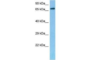 Host:  Mouse  Target Name:  DACH2  Sample Tissue:  Mouse Liver  Antibody Dilution:  1ug/ml (DACH2 anticorps  (C-Term))