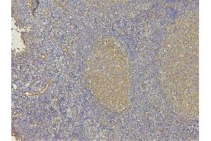 IHC analysis of EHD1 using anti-EHD1 antibody (ABIN6719599). (EHD1 anticorps  (AA 324-516))