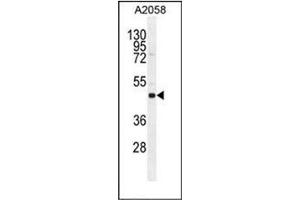 Western blot analysis in A2058 cell line lysates using SOCS4 Antibody  (35ug/lane). (SOCS4 anticorps  (AA 234-262))