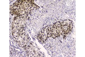 IHC analysis of CRM1 using anti-CRM1 antibody .