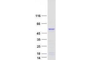 Validation with Western Blot