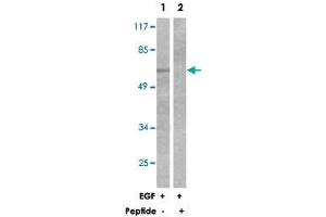 Western blot analysis of extracts from 293 cells, treated with EGF (200 ng/mL, 30 mins), using OPRM1 polyclonal antibody . (Mu Opioid Receptor 1 anticorps)
