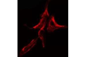 ABIN6275115 staining HuvEc cells by IF/ICC. (KDELR2 anticorps  (Internal Region))