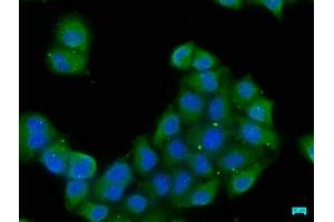 Immunofluorescence staining of Hela cells with ABIN7152261 at 1:50, counter-stained with DAPI. (EXOC8 anticorps  (AA 508-725))