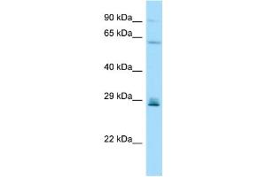 WB Suggested Anti-CD99L2 Antibody Titration: 1. (CD99L2 anticorps  (Middle Region))