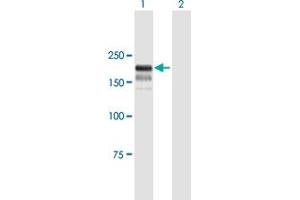 Western Blot analysis of BTBD12 expression in transfected 293T cell line by BTBD12 MaxPab polyclonal antibody. (BTBD12 anticorps  (AA 1-1151))