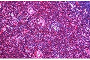 Human Thymus: Formalin-Fixed, Paraffin-Embedded (FFPE) (IGF2R anticorps  (AA 2441-2490))