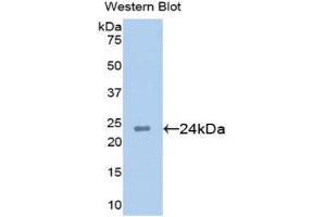 Western Blotting (WB) image for anti-Anterior Gradient Homolog 2 (Xenopus Laevis) (AGR2) (AA 21-175) antibody (ABIN1077803) (AGR2 anticorps  (AA 21-175))