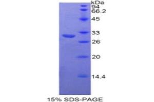 SDS-PAGE analysis of Human Neurofascin Protein. (NFASC Protéine)