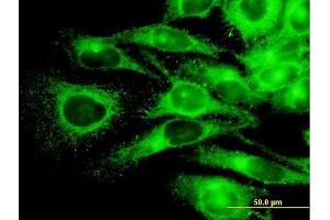 Immunofluorescence of monoclonal antibody to PRKAR2A on HeLa cell.