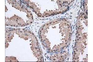 Immunohistochemical staining of paraffin-embedded Human lung tissue using anti-ACAT2 mouse monoclonal antibody. (ACAT2 anticorps)
