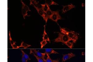 Immunofluorescence analysis of NIH-3T3 cells using ERK1 / ERK2 Polyclonal Antibody at dilution of 1:100 (40x lens). (ERK1/2 anticorps)