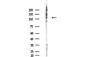 anti-Squamous Cell Carcinoma Antigen Recognized By T Cells 3 (SART3) (C-Term) antibody