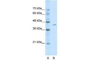 ZBTB26 antibody used at 0. (ZBTB26 anticorps  (Middle Region))