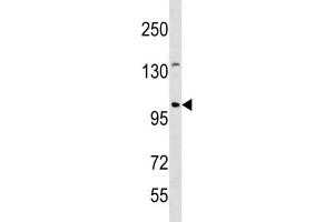 Western Blotting (WB) image for anti-Establishment of Cohesion 1 Homolog 1 (ESCO1) antibody (ABIN3004513) (ESCO1 anticorps)