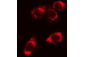 ABIN6266984 staining Hela cells by IF/ICC. (STARD13 anticorps  (N-Term))