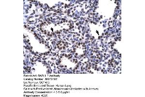 Human Lung (BARHL2 anticorps  (Middle Region))