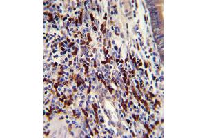 Immunohistochemistry (IHC) image for anti-CCR4-NOT Transcription Complex, Subunit 8 (CNOT8) antibody (ABIN3002662) (CNOT8 anticorps)