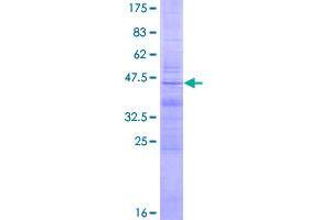 Image no. 1 for Lymphocyte Antigen 86 (LY86) (AA 1-162) protein (GST tag) (ABIN1309910)