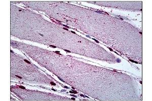 Immunohistochemistry (IHC) image for anti-Mesenchyme Homeobox 2 (MEOX2) antibody (ABIN781935)