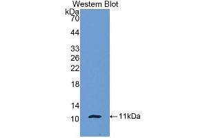 Western blot analysis of the recombinant protein. (beta-Thromboglobulin anticorps  (AA 40-113))