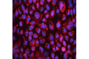 IF analysis of FACL4/ACSL4 using anti-FACL4/ACSL4 antibody (ABIN7602756). (ACSL4 anticorps  (C-Term))