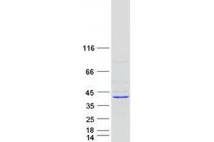 Validation with Western Blot