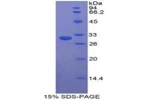 SDS-PAGE analysis of Human STAM Binding Protein. (STAMBP Protéine)