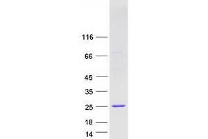 Validation with Western Blot