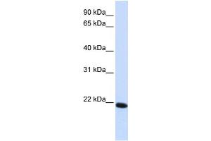 WB Suggested Anti-CLDN19 Antibody Titration:  0. (Claudin 19 anticorps  (C-Term))