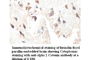 Image no. 1 for anti-Catenin (Cadherin-Associated Protein), alpha 2 (CTNNA2) antibody (ABIN791201) (CTNNA2 anticorps)