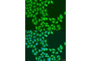 Immunofluorescence analysis of U2OS cells using STAT5A antibody (ABIN2737605) at dilution of 1:100. (STAT5A anticorps)