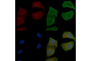ABIN6258697 and ABIN6274912 staining Hela cells by IF/ICC.