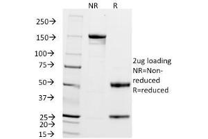 SDS-PAGE Analysis Purified ZAP70 Mouse Monoclonal Antibody (2F3.