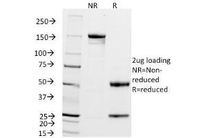 SDS-PAGE Analysis Purified ZAP70 Mouse Monoclonal Antibody (2F3. (ZAP70 anticorps  (AA 1-254))