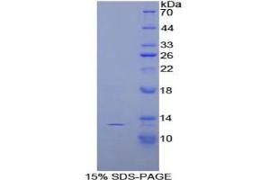SDS-PAGE analysis of Rat Slit Homolog 3 Protein. (SLIT3 Protéine)