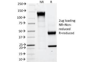 SDS-PAGE Analysis Purified CAIX Mouse Monoclonal Antibody (CA9/781). (CA9 anticorps)