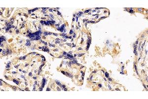 Detection of IL13Ra1 in Human Placenta Tissue using Polyclonal Antibody to Interleukin 13 Receptor Alpha 1 (IL13Ra1)