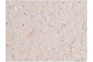 ABIN6255994 and ABIN6267364 at 1/200 staining Rat brain tissue sections by IHC-P.