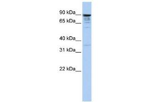 MCTP1 antibody used at 1 ug/ml to detect target protein. (MCTP1 anticorps  (Middle Region))