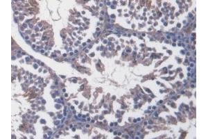 Detection of vWF in Mouse Testis Tissue using Polyclonal Antibody to Von Willebrand Factor (vWF)